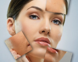 FOTOREJUVENECIMIENTO IPL Diana